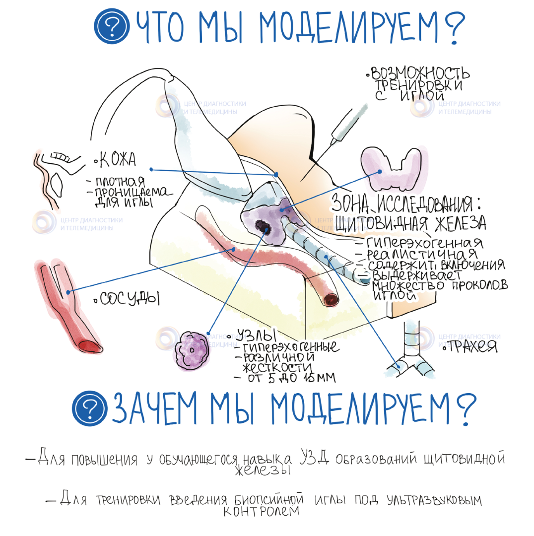 Фантом щитовидной железы для УЗ диагностики и манипуляций
